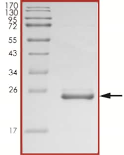 Sino Biological&nbsp;Recombinant Human HRAS Protein (G12C, His & TEV Tag)